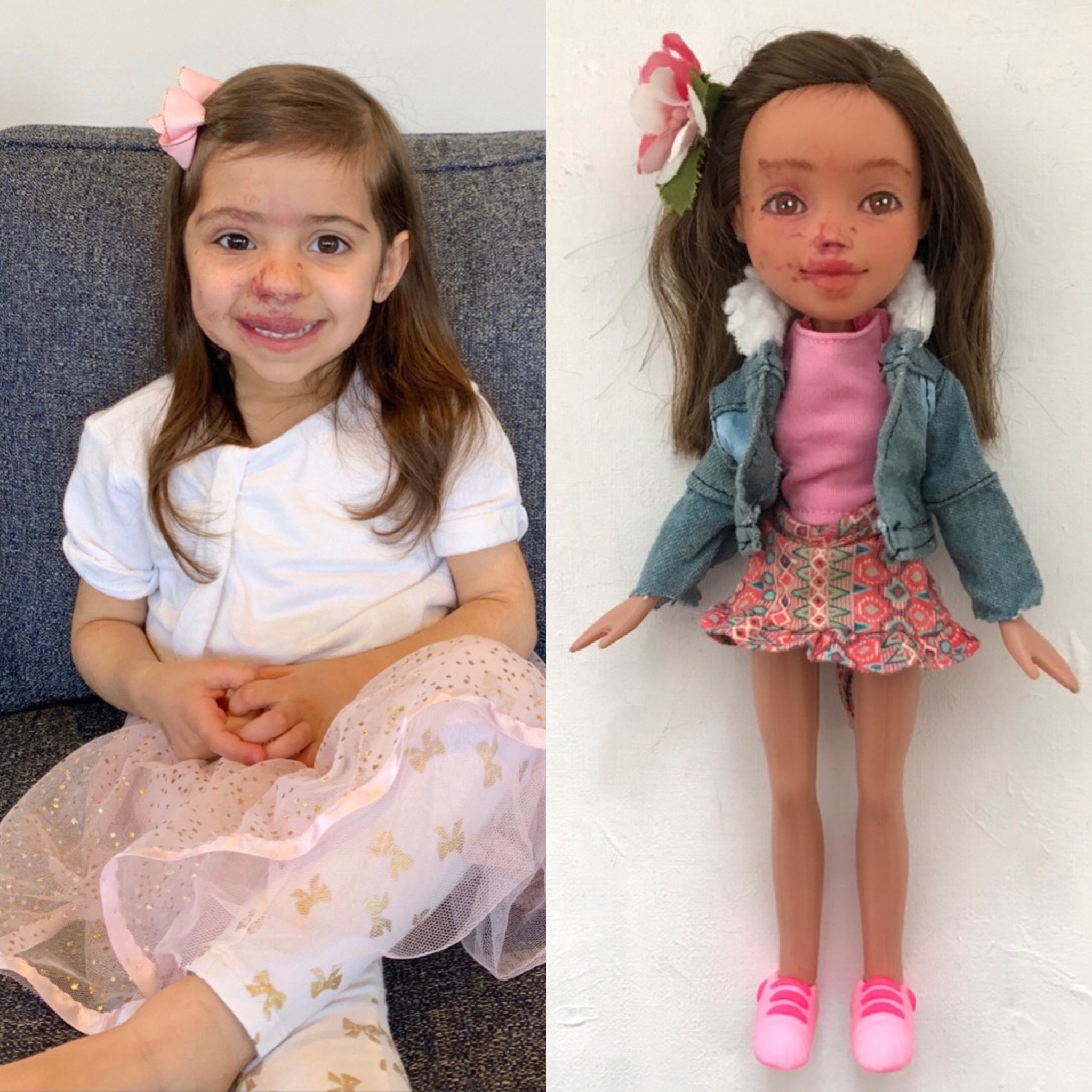 A child with a facial birthmark smiling beside her custom-made doll, painted to look just like her